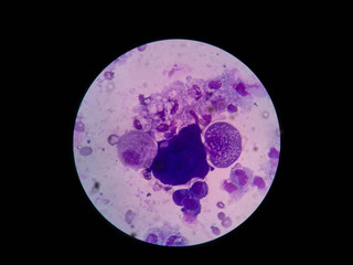 Mononuclear cells 815.jpg