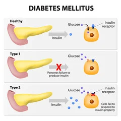 Research 540 Diabetes.jpg