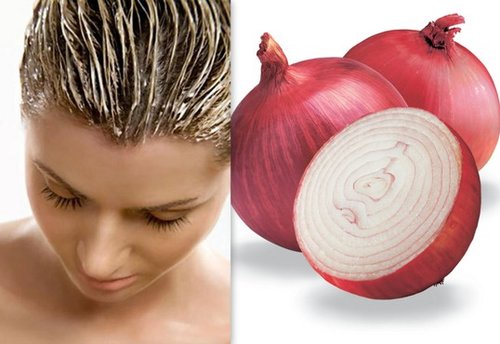 Onion-Hair-Mask.jpg