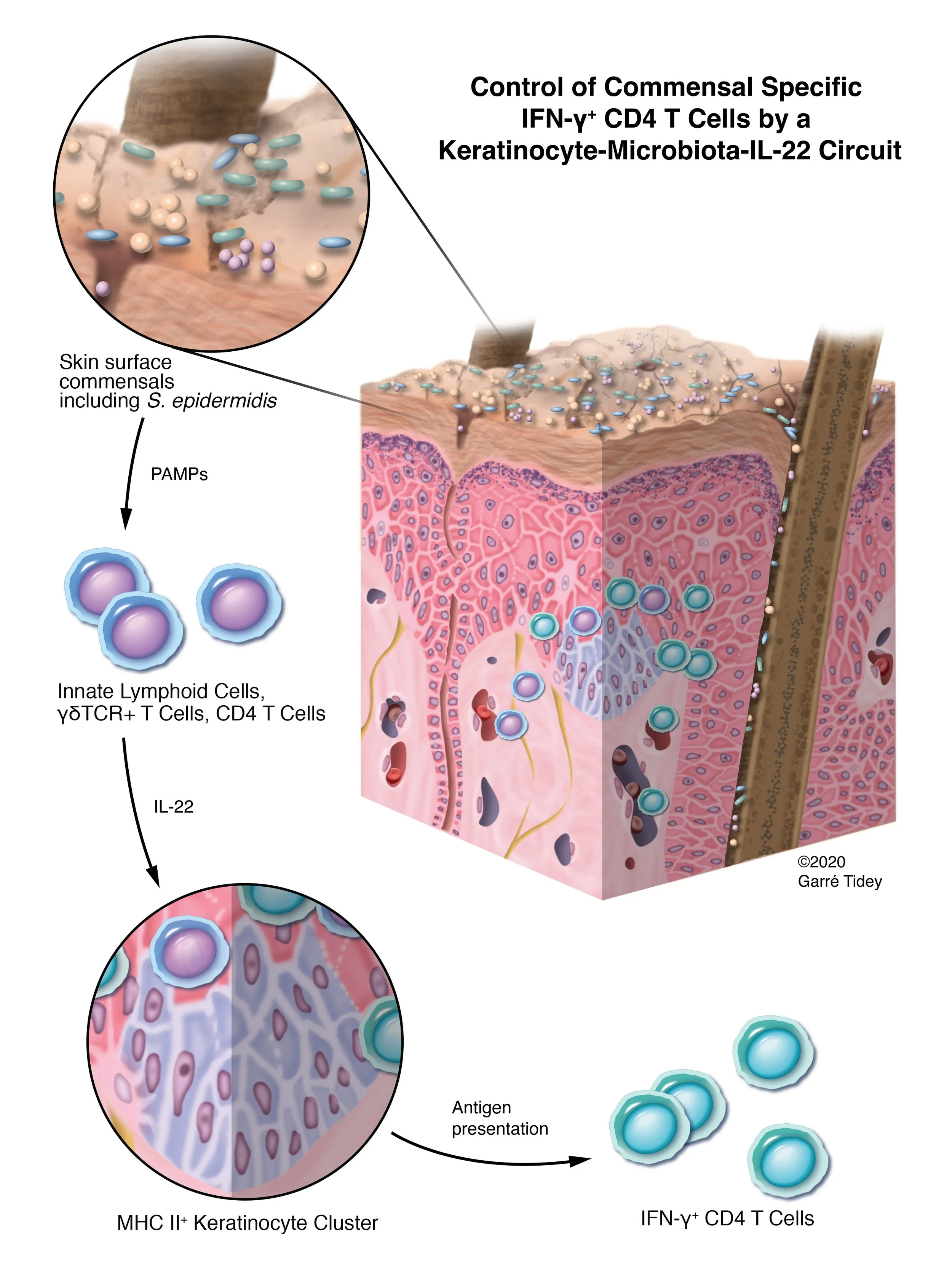 Control of Commensal Specific IFNy+ CD4 T Cells by a Keratinocyte-Microbiota-IL-22 Circuit. Media: Adobe Photoshop, Adobe Illustrator, Adobe InDesign