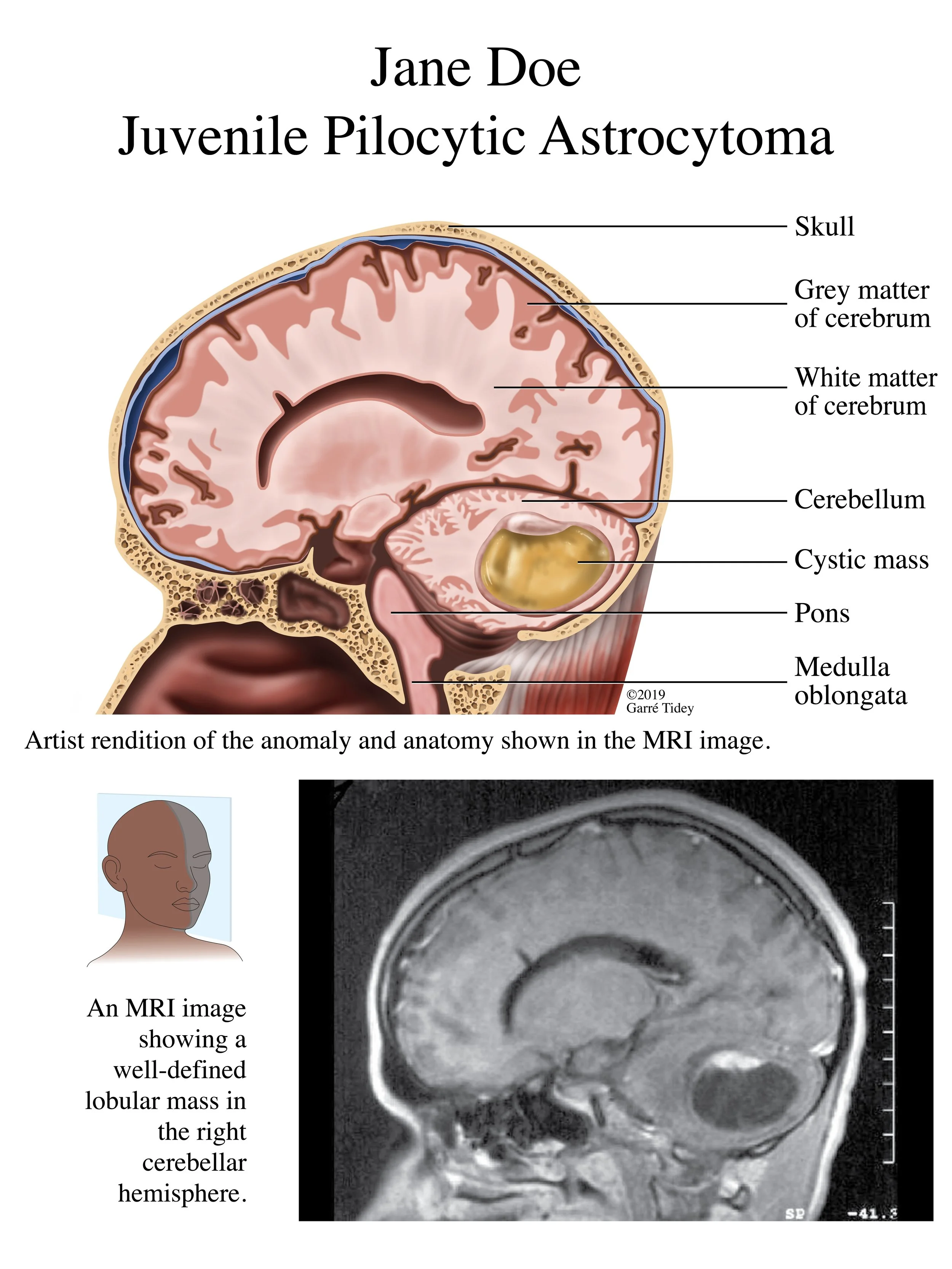 Medical Legal Radiographic Interpretation. Media: Adobe Photoshop, Adobe Illustrator, Adobe InDesign