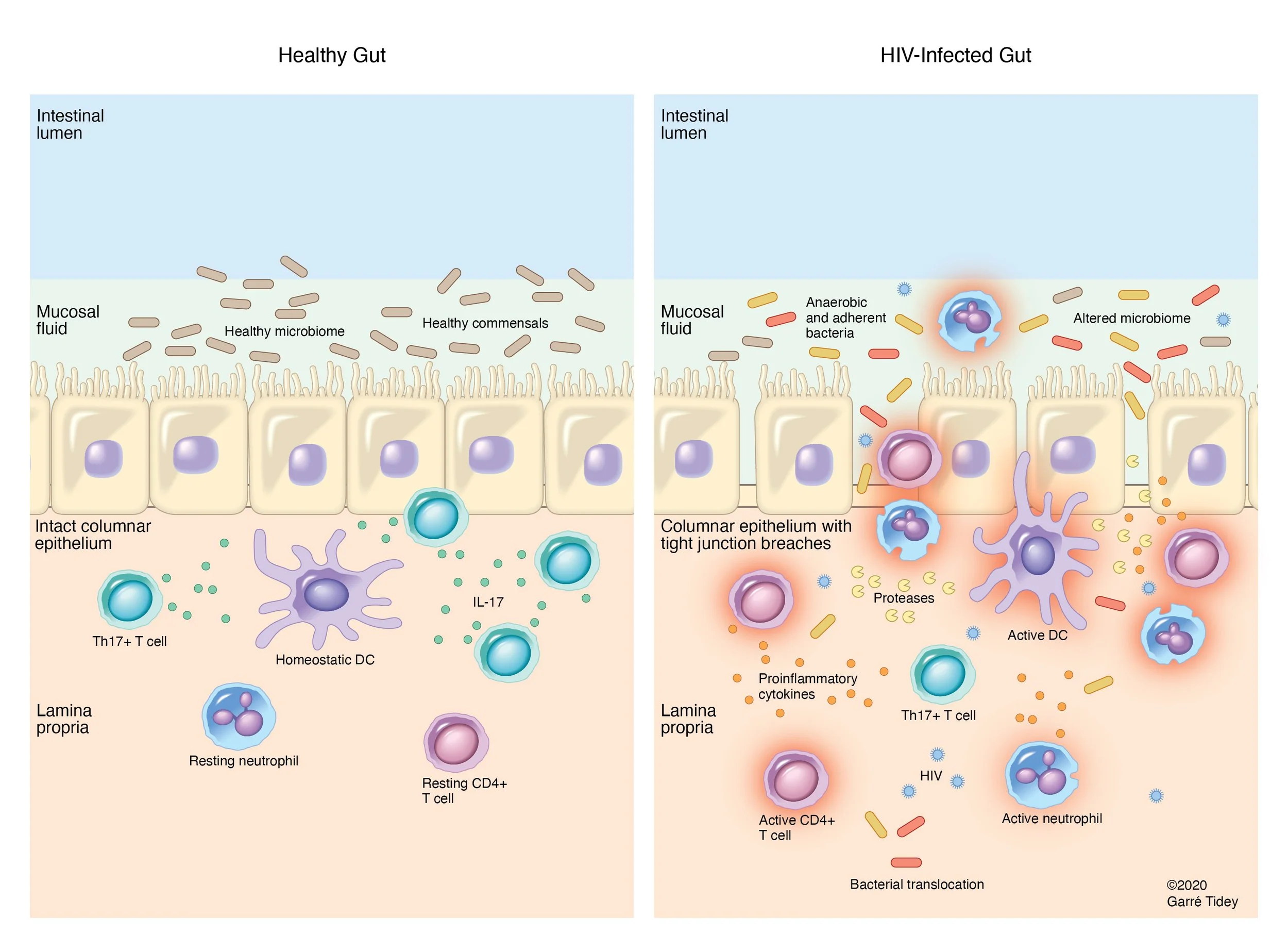 Dysbiosis of the HIV+ Intestinal Epithelium. Media: Adobe Illustrator
