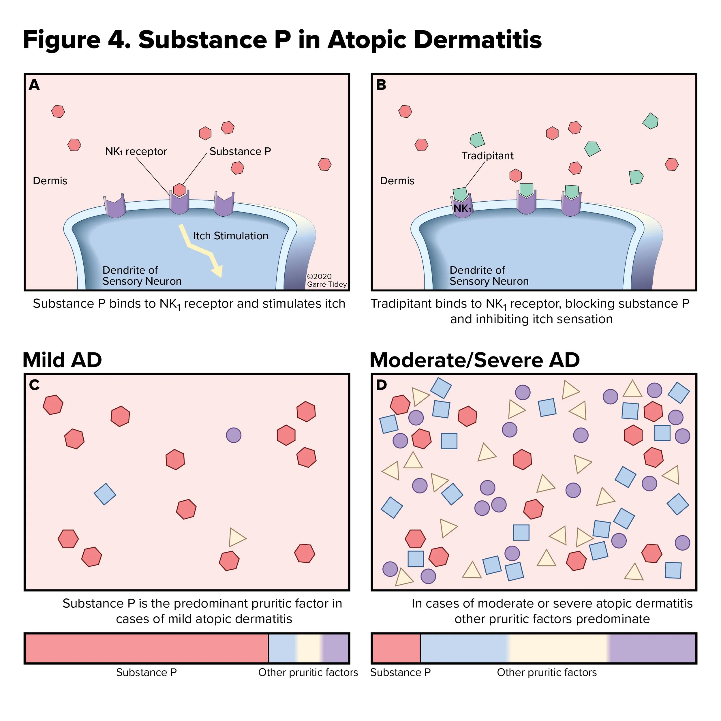 Substance P Binding and Tradipitant Outcompeting at the NK1 Receptor in Atopic Dermatitis. Media: Adobe Illustrator