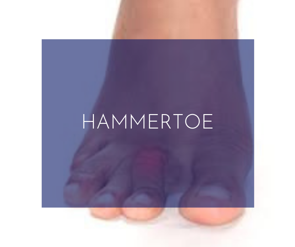 Toenail Reconstruction-12.png