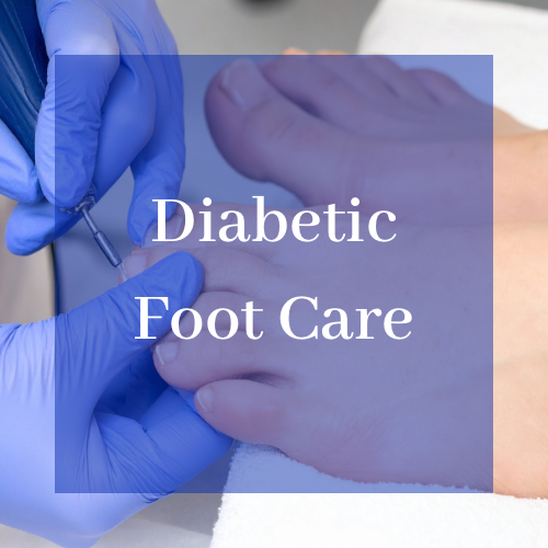 Diabetic foot care treatment by podiatrist in Bangor Northern Ireland