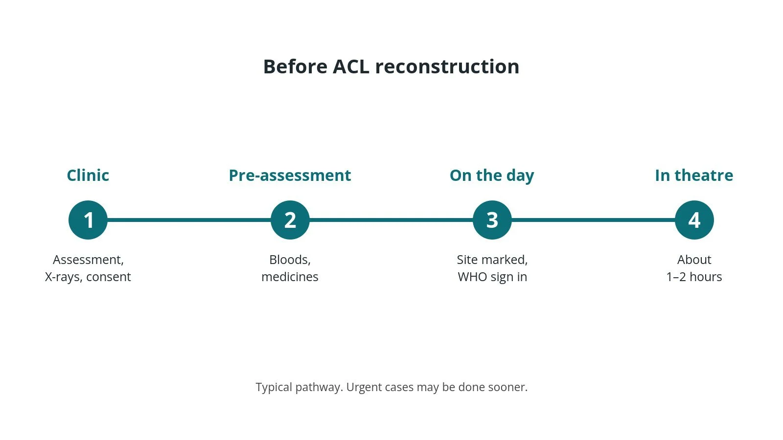Timeline of the usual steps before ACL reconstruction: Clinic: Assessment, X-rays, consent, Pre-assessment: Bloods, medicines, On the day: Site marked, WHO sign in, In theatre: About 1–2 hours
