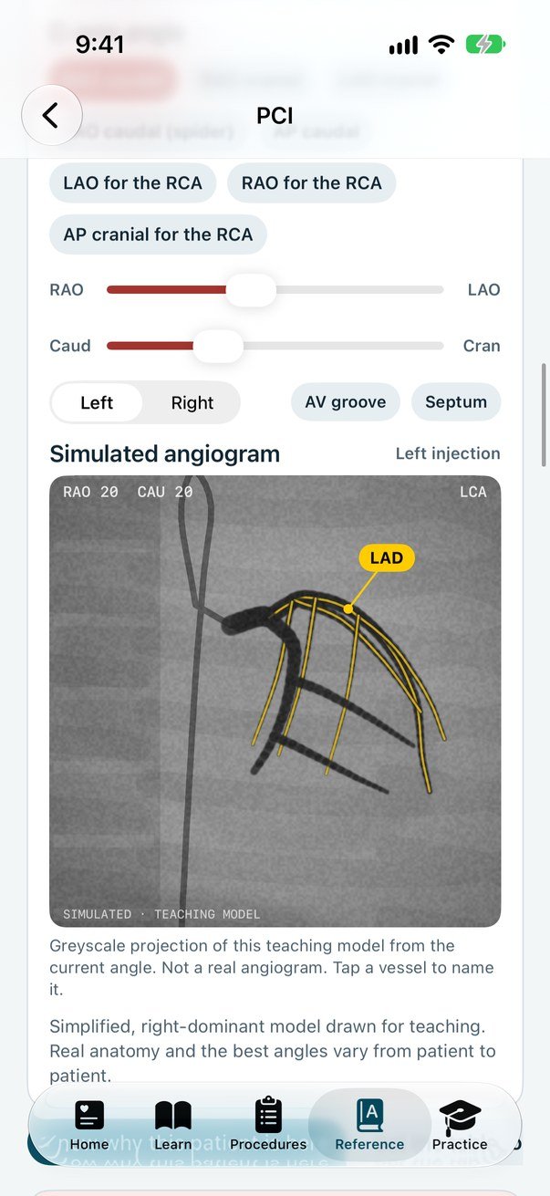 Cath Lab 101 on iPhone: C-arm angle sliders above a simulated angiogram at RAO 20, caudal 20, labelled as a teaching model