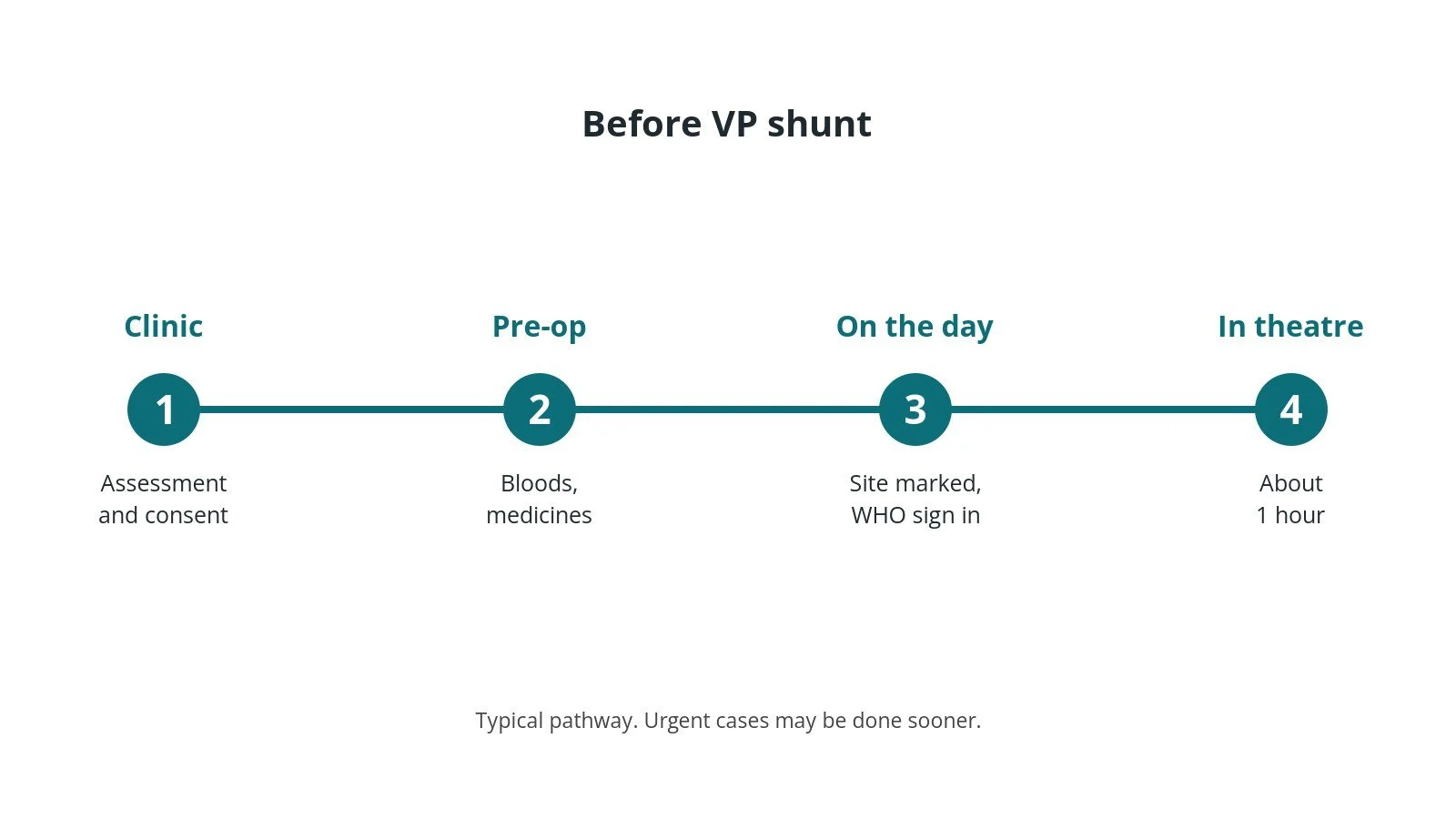Timeline of the usual steps before VP shunt: Clinic: Assessment and consent, Pre-op: Bloods, medicines, On the day: Site marked, WHO sign in, In theatre: About 1 hour
