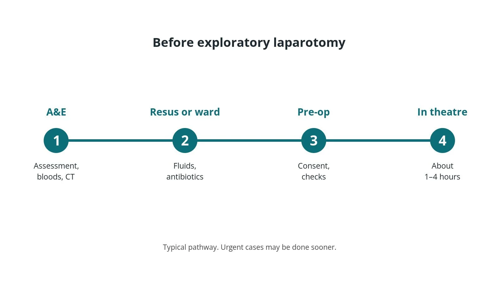 Timeline of the usual steps before exploratory laparotomy: A&E: Assessment, bloods, CT, Resus or ward: Fluids, antibiotics, Pre-op: Consent, checks, In theatre: About 1–4 hours