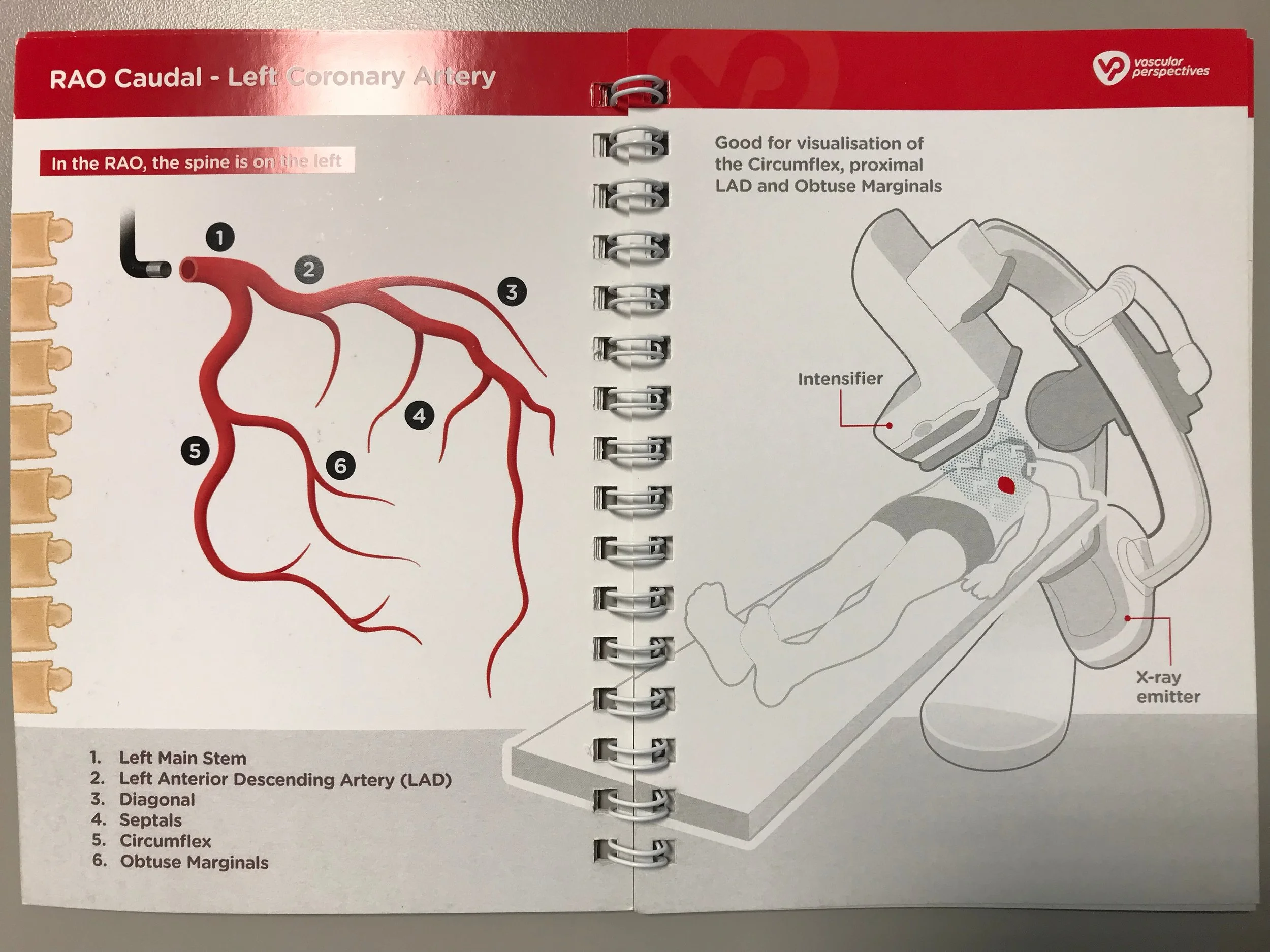 Coronary Angiogram — Golden Shutter Films