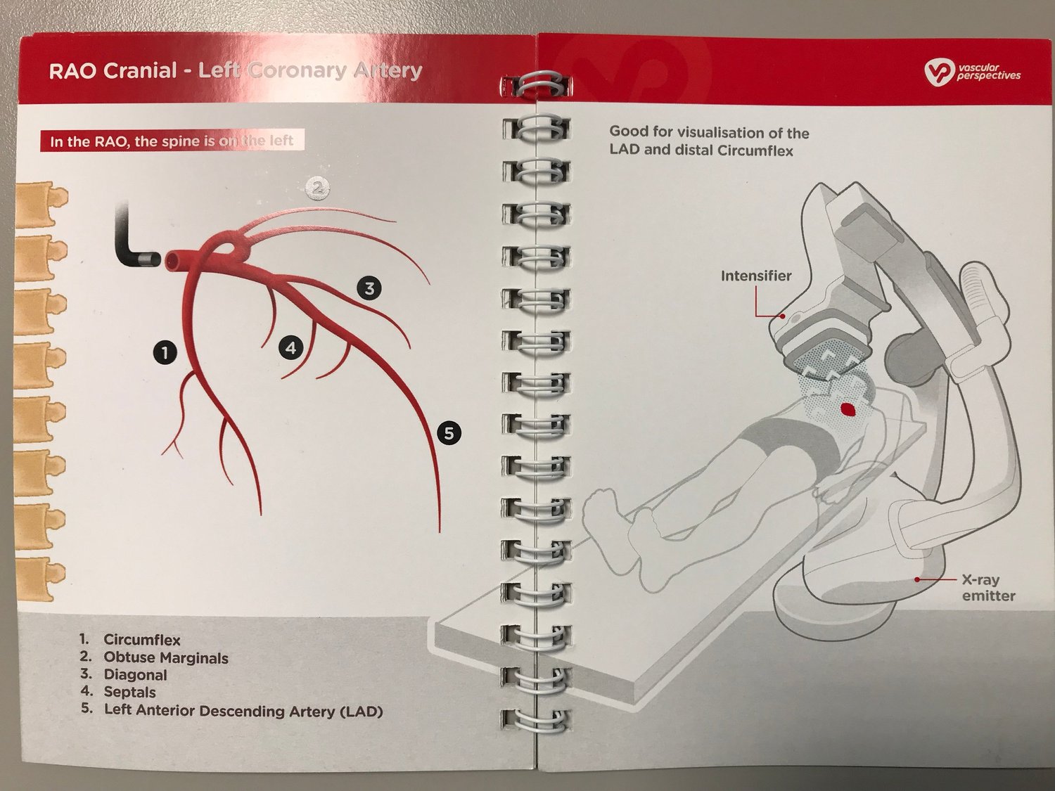 Coronary Angiogram — Golden Shutter Films
