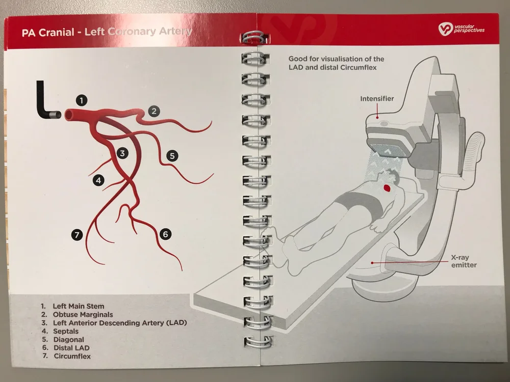 Coronary Angiogram — Golden Shutter Films