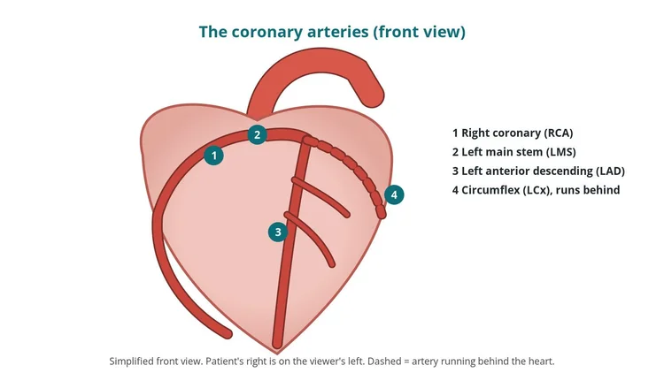Cardiology guide diagram