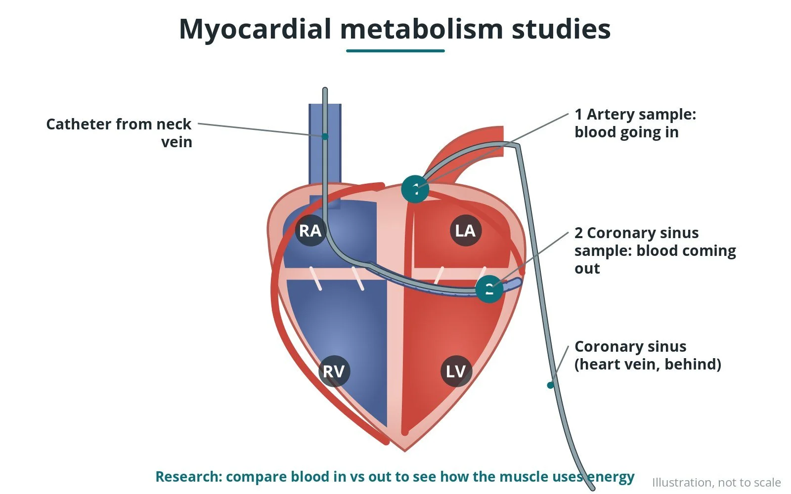 Myocardial metabolism studies (research): a Cath Lab 101 guide