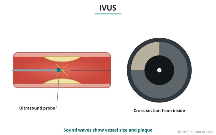 Imaging and physiology guide diagram