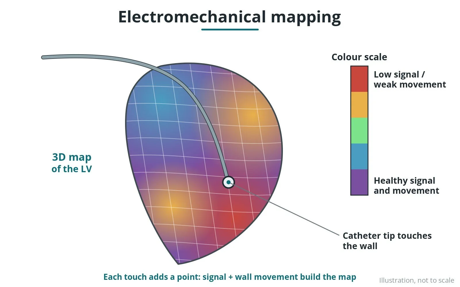 Electroanatomical and electromechanical mapping: a Cath Lab 101 guide
