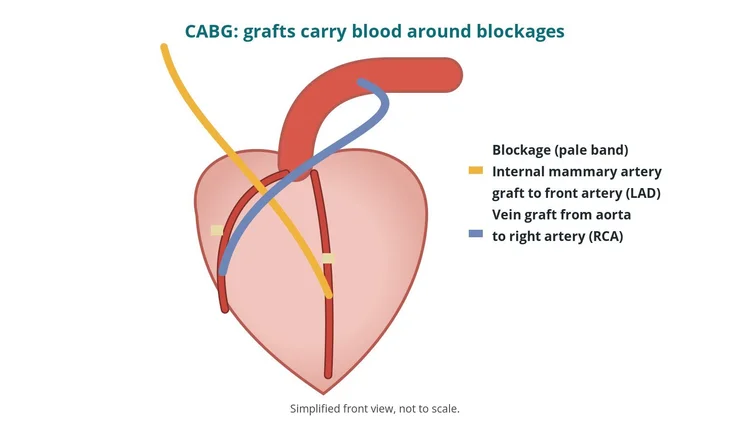 Cardiothoracic guide diagram