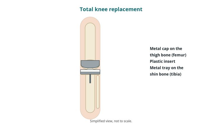 Orthopaedics guide diagram