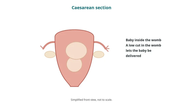 Obstetrics & gynaecology guide diagram