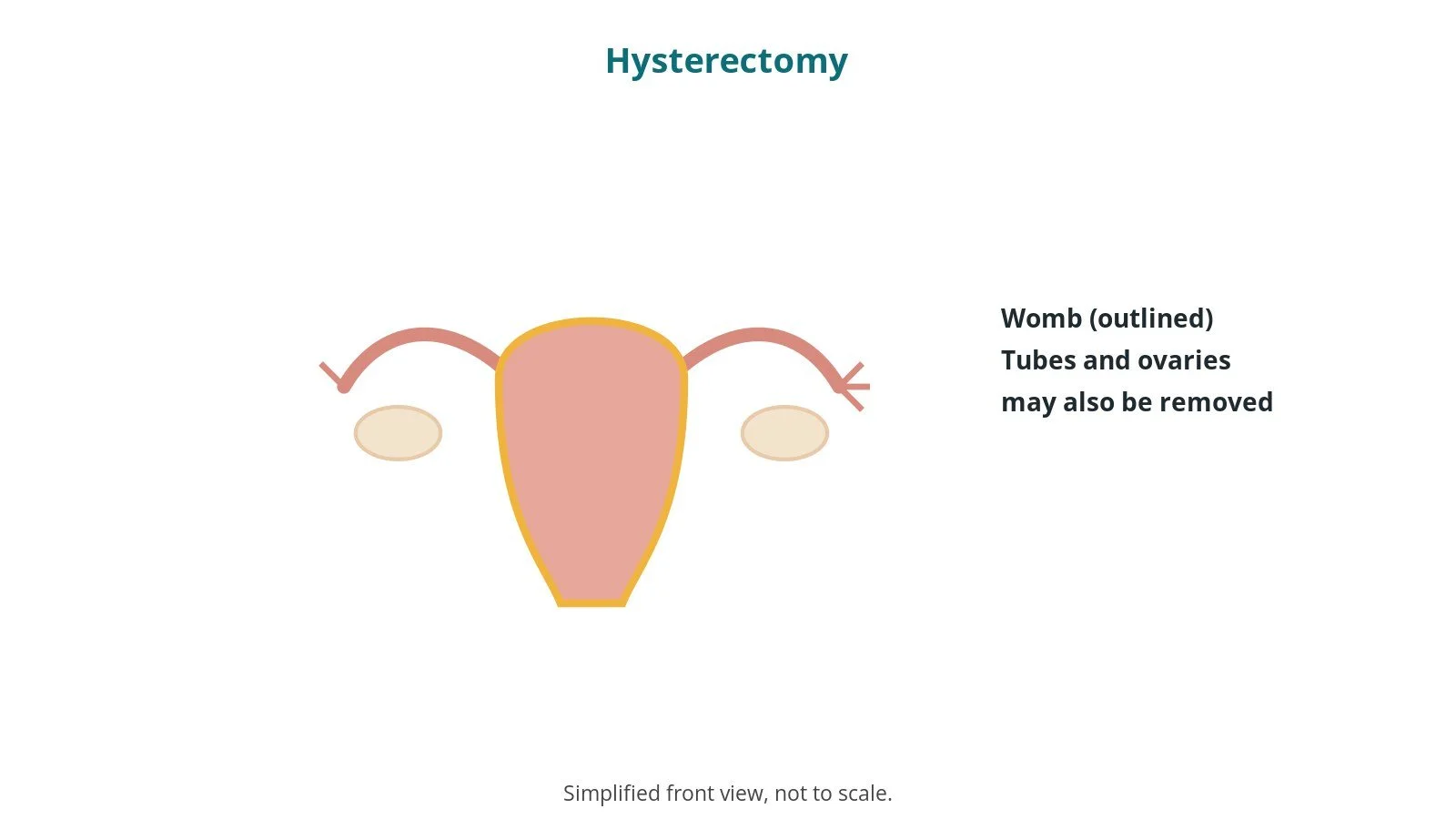 Hysterectomy: an OR 101 guide