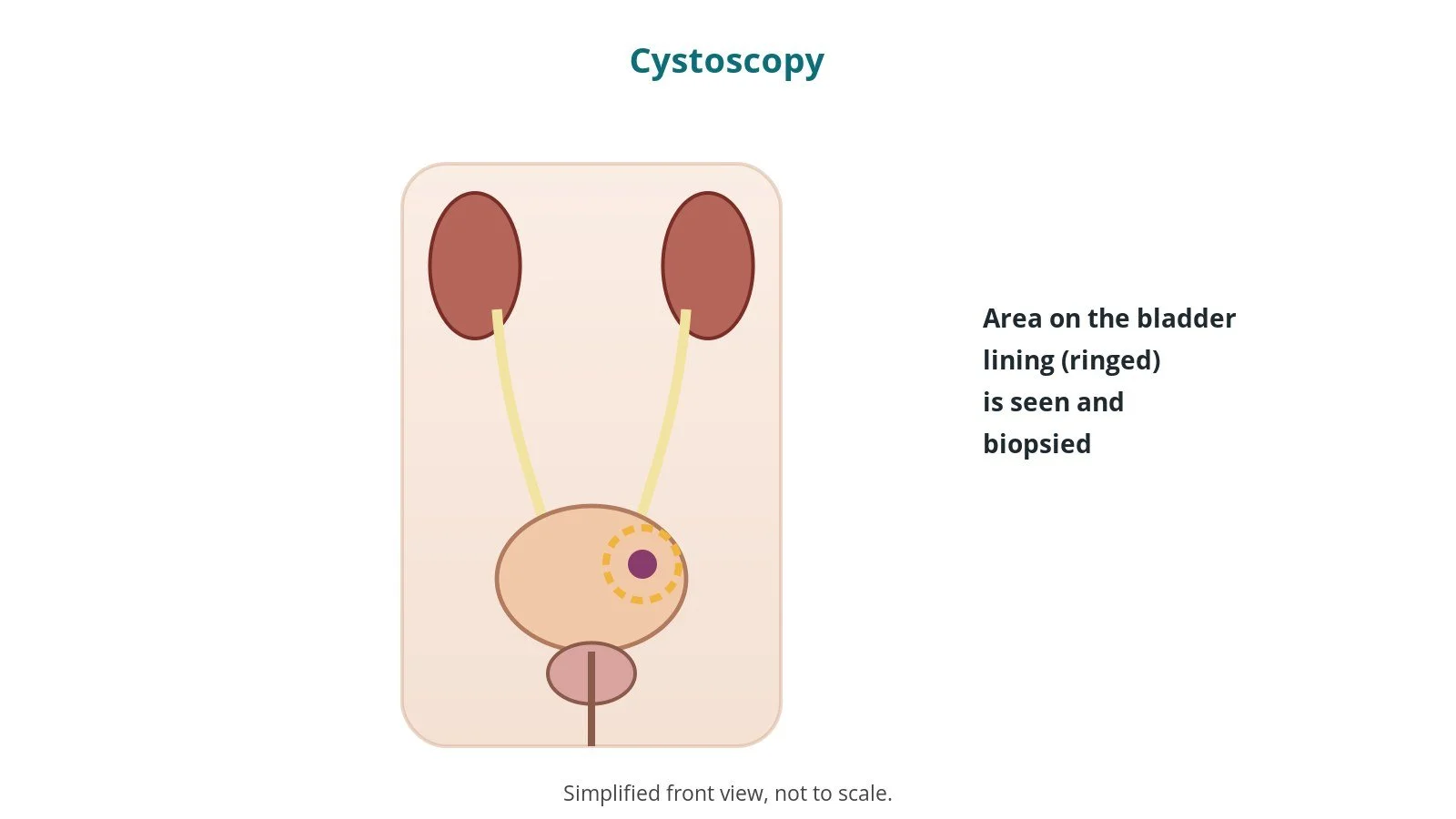 Cystoscopy: an OR 101 guide