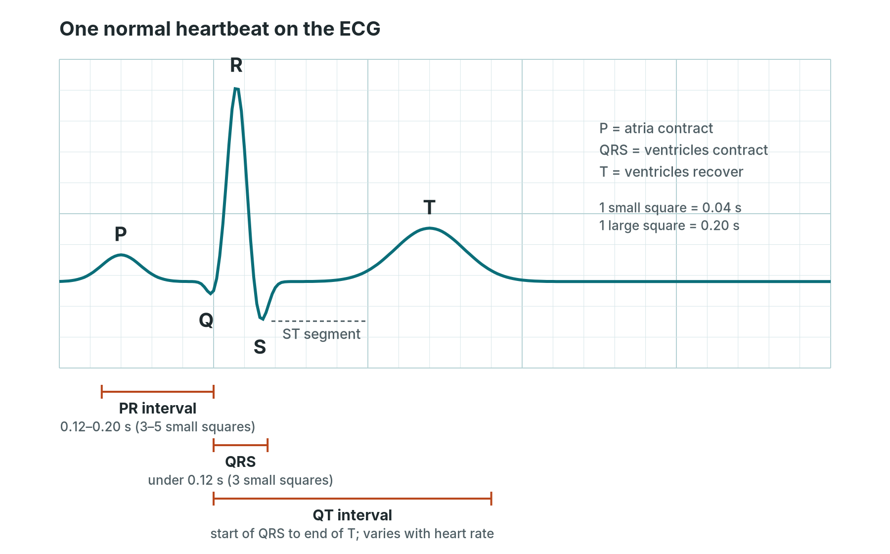 Labelled normal ECG waveform showing the P wave, QRS complex, T wave, PR interval, QRS width and QT interval