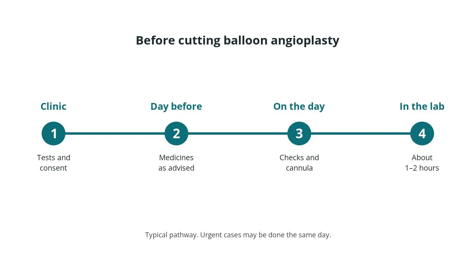 Timeline of the usual steps before cutting balloon angioplasty: clinic tests and consent, medicine advice, checks on the day, and the procedure