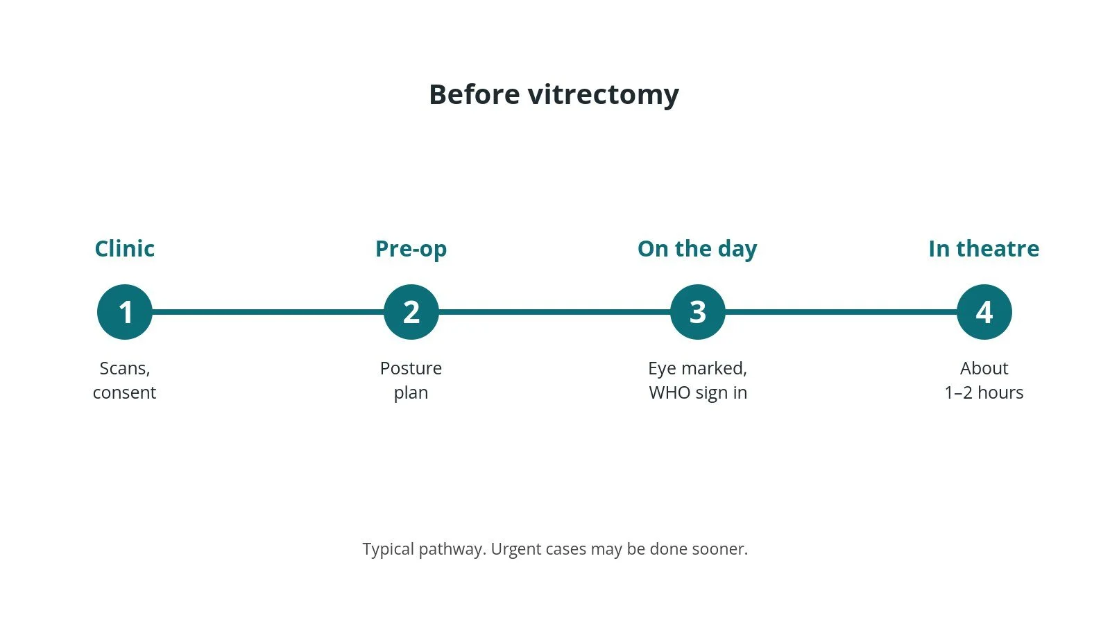 Timeline of the usual steps before vitrectomy: Clinic: Scans, consent, Pre-op: Posture plan, On the day: Eye marked, WHO sign in, In theatre: About 1–2 hours