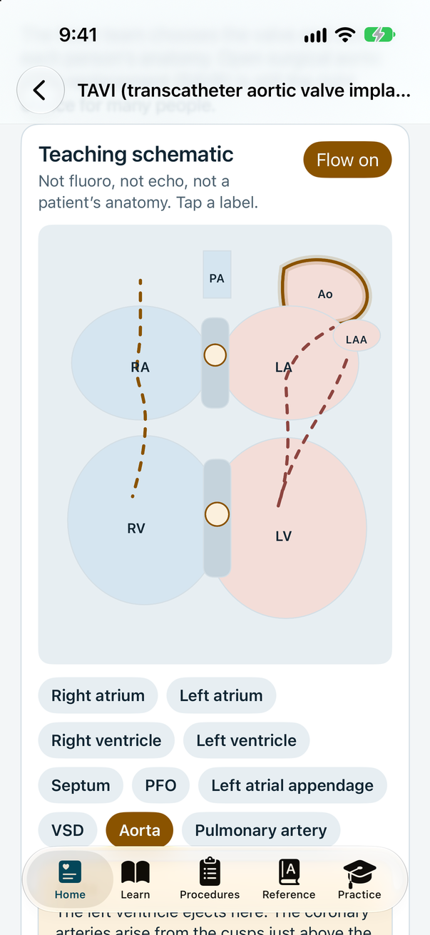 Cath Lab 101 app: tappable teaching schematic of the heart chambers from the TAVI guide