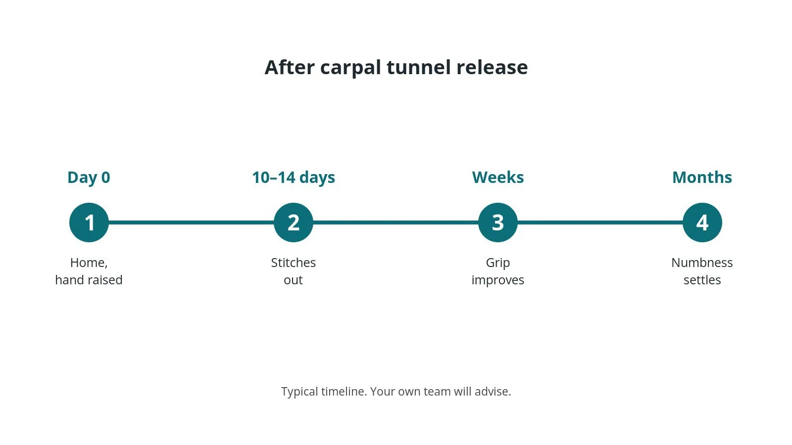 Recovery timeline after carpal tunnel release: Day 0: Home, hand raised, 10–14 days: Stitches out, Weeks: Grip improves, Months: Numbness settles