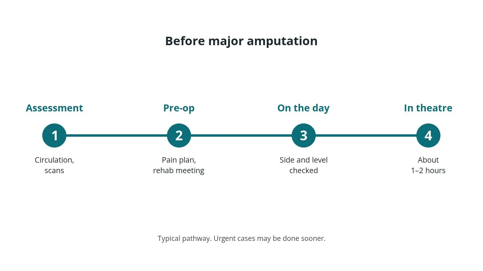 Timeline of the usual steps before major amputation: Assessment: Circulation, scans, Pre-op: Pain plan, rehab meeting, On the day: Side and level checked, In theatre: About 1–2 hours