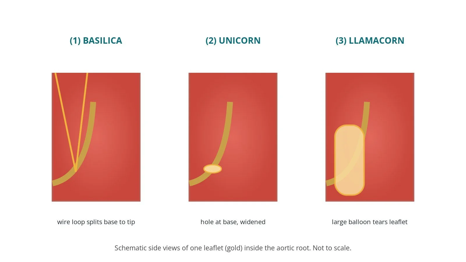 Three-panel comparison of leaflet modification: BASILICA wire loop splitting a leaflet, UNICORN small hole widened with a balloon, and LLAMACORN large balloon tearing the leaflet