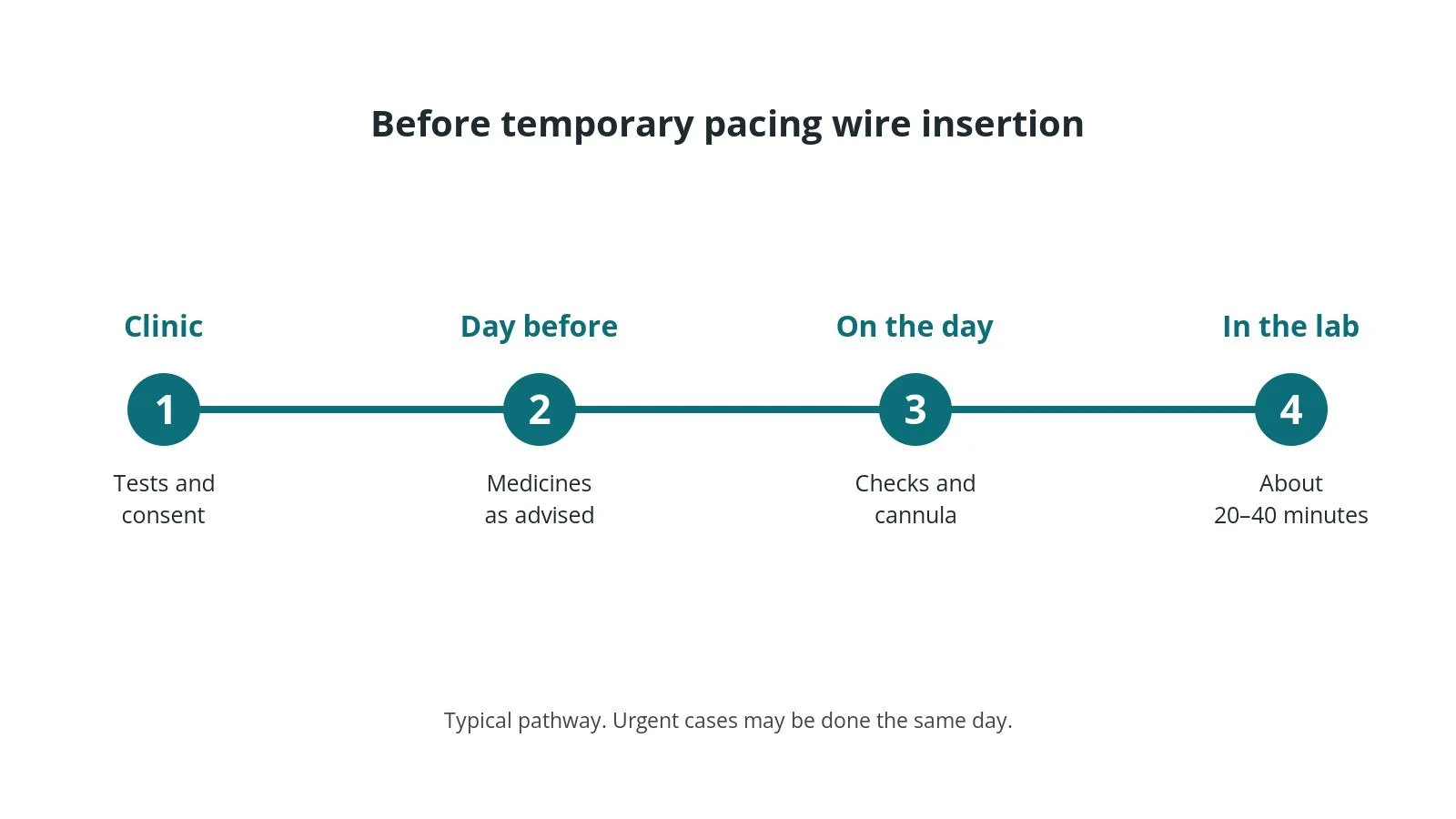 Timeline of the usual steps before temporary pacing wire insertion: clinic tests and consent, medicine advice, checks on the day, and the procedure
