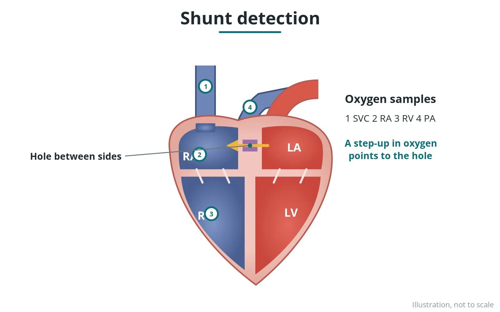 Diagram of the heart showing blood samples taken from each chamber to measure oxygen levels