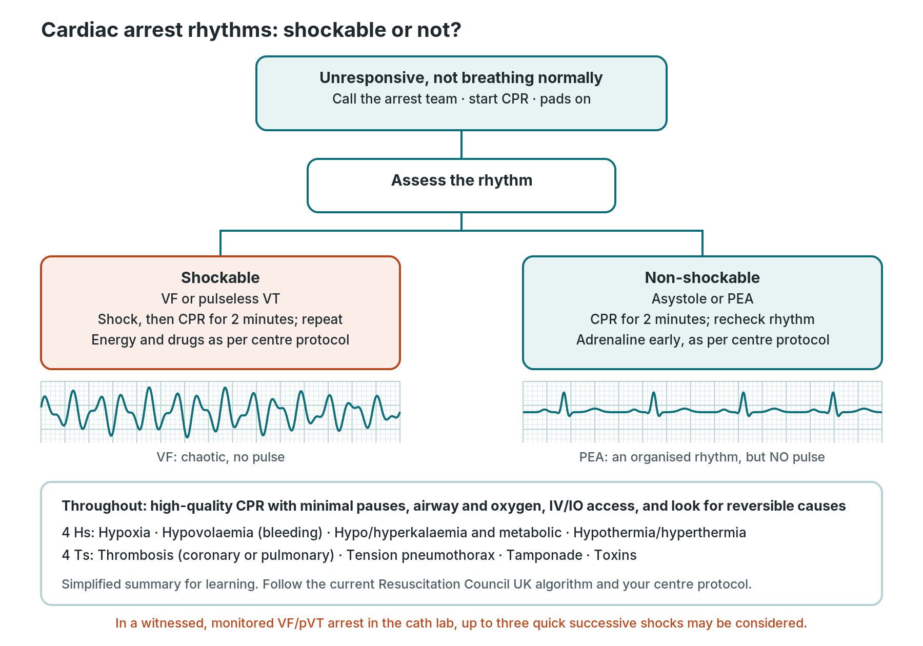 Simplified cardiac arrest rhythm summary: shockable VF and pulseless VT versus non-shockable asystole and PEA, with the 4 Hs and 4 Ts reversible causes