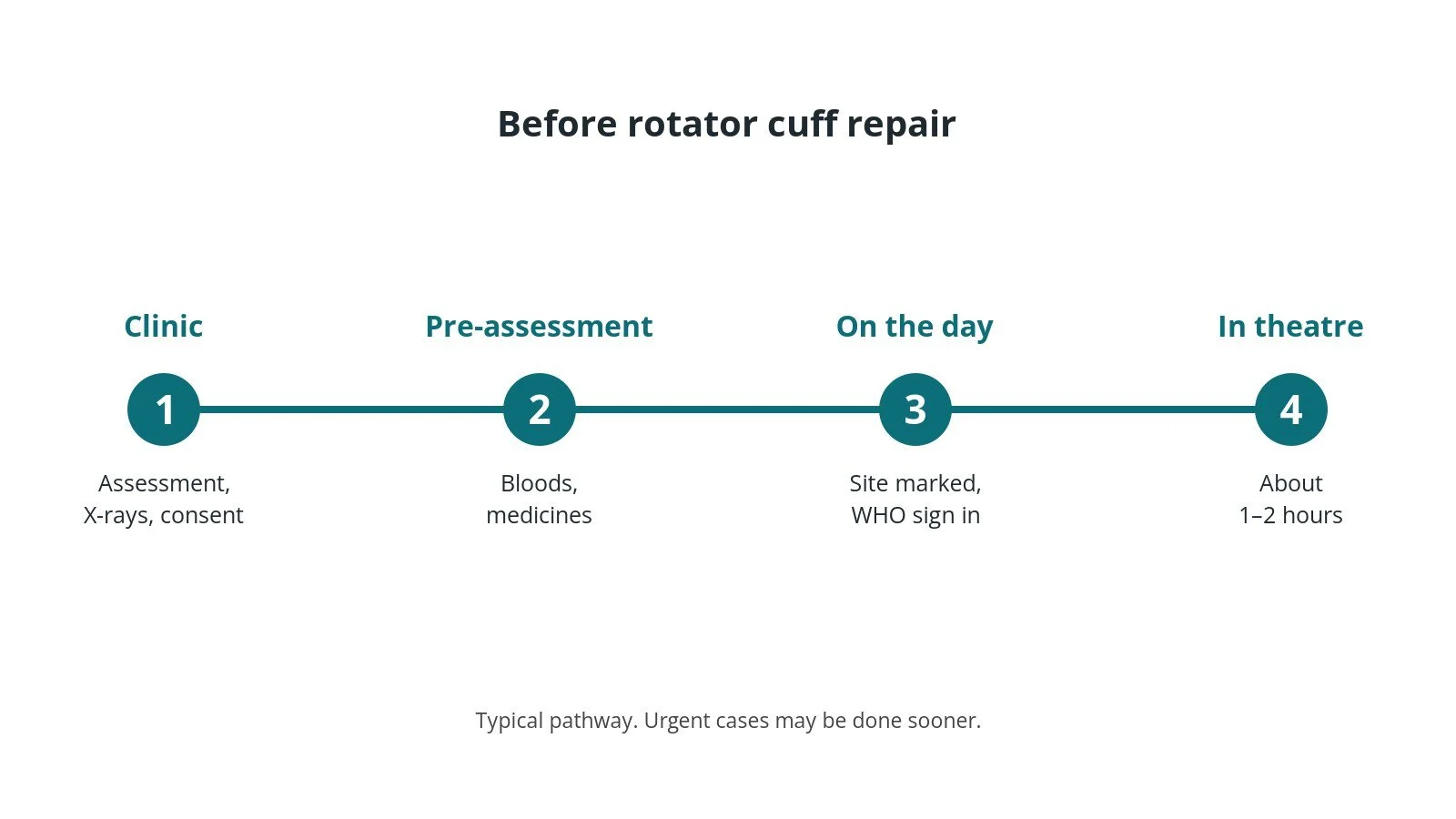 Timeline of the usual steps before rotator cuff repair: Clinic: Assessment, X-rays, consent, Pre-assessment: Bloods, medicines, On the day: Site marked, WHO sign in, In theatre: About 1–2 hours