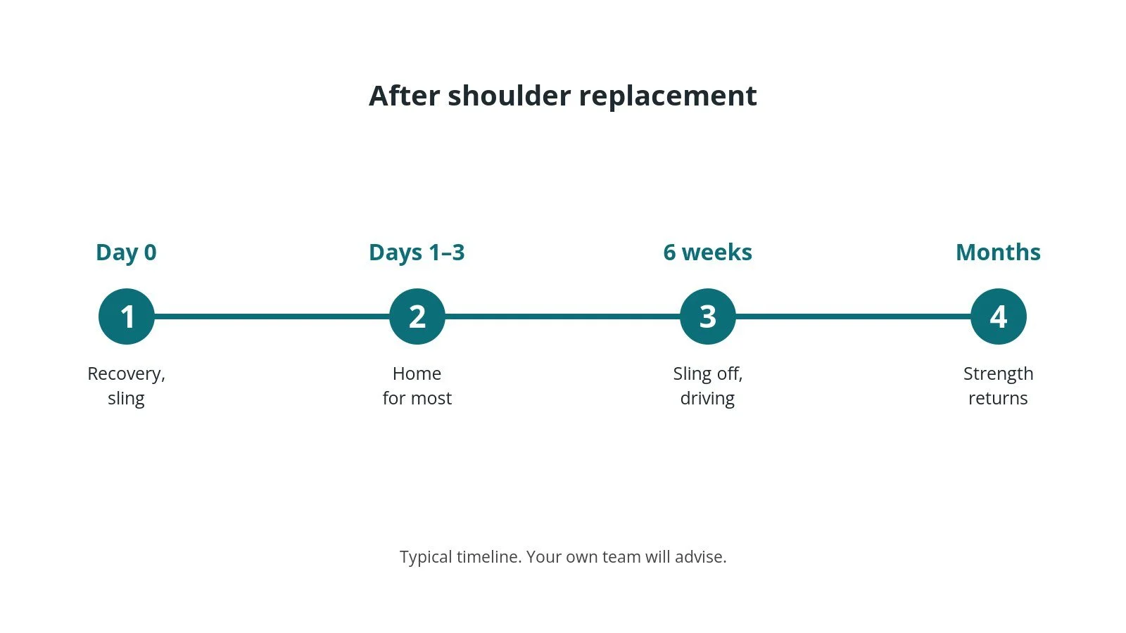 Recovery timeline after shoulder replacement: Day 0: Recovery, sling, Days 1–3: Home for most, 6 weeks: Sling off, driving, Months: Strength returns