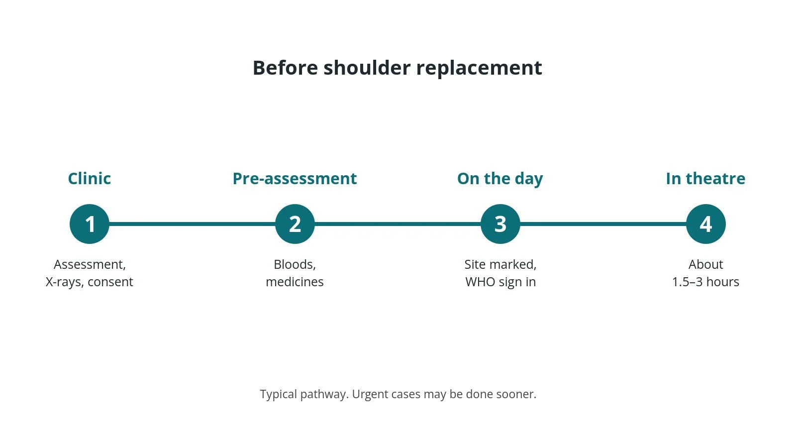 Timeline of the usual steps before shoulder replacement: Clinic: Assessment, X-rays, consent, Pre-assessment: Bloods, medicines, On the day: Site marked, WHO sign in, In theatre: About 1.5–3 hours