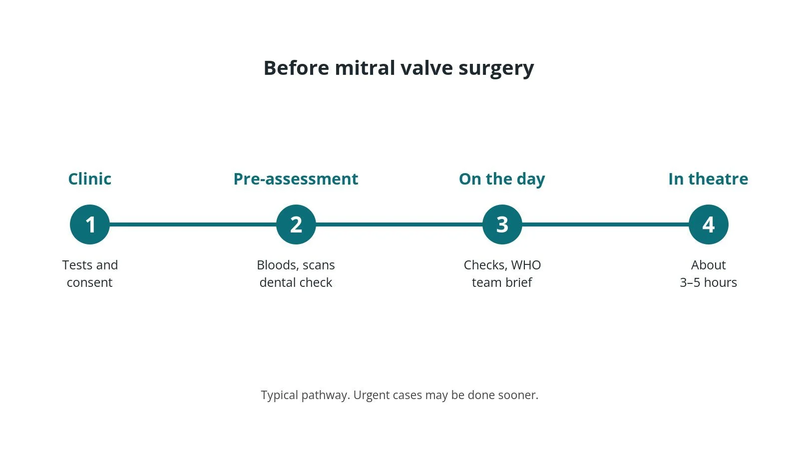 Timeline of the usual steps before mitral valve surgery: Clinic: Tests and consent, Pre-assessment: Bloods, scans dental check, On the day: Checks, WHO team brief, In theatre: About 3–5 hours