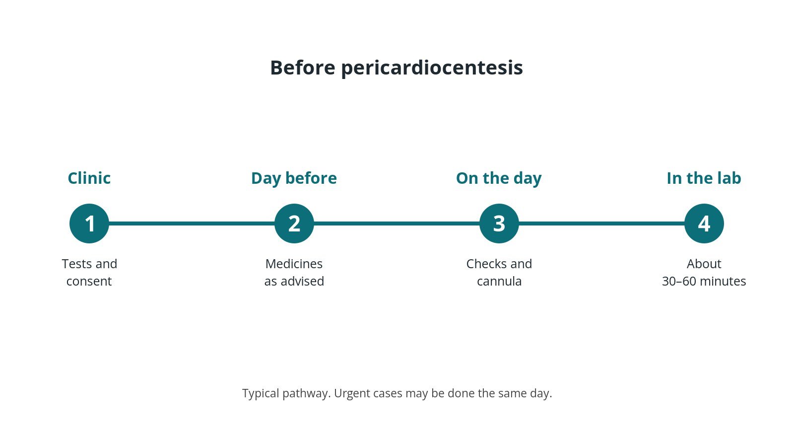 Timeline of the usual steps before pericardiocentesis: clinic tests and consent, medicine advice, checks on the day, and the procedure