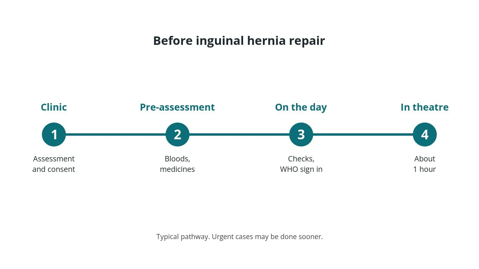 Timeline of the usual steps before inguinal hernia repair: Clinic: Assessment and consent, Pre-assessment: Bloods, medicines, On the day: Checks, WHO sign in, In theatre: About 1 hour