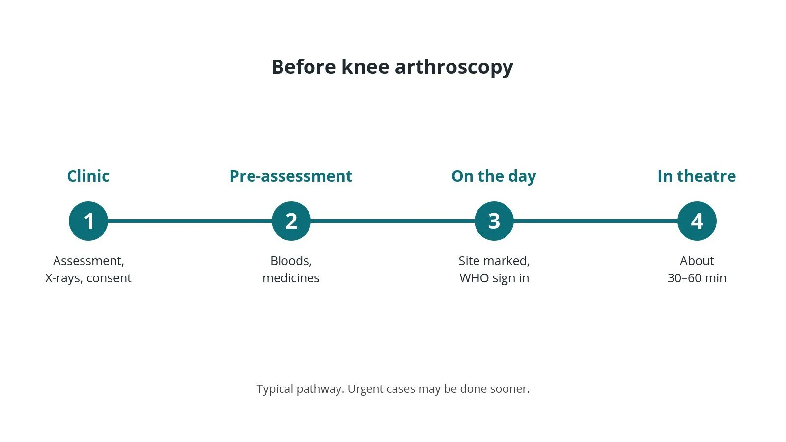 Timeline of the usual steps before knee arthroscopy: Clinic: Assessment, X-rays, consent, Pre-assessment: Bloods, medicines, On the day: Site marked, WHO sign in, In theatre: About 30–60 min