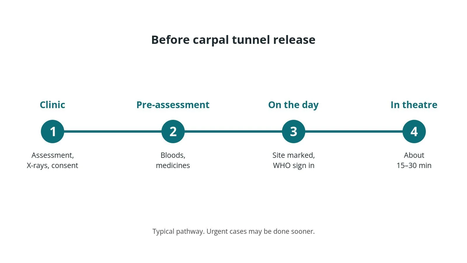 Timeline of the usual steps before carpal tunnel release: Clinic: Assessment, X-rays, consent, Pre-assessment: Bloods, medicines, On the day: Site marked, WHO sign in, In theatre: About 15–30 min