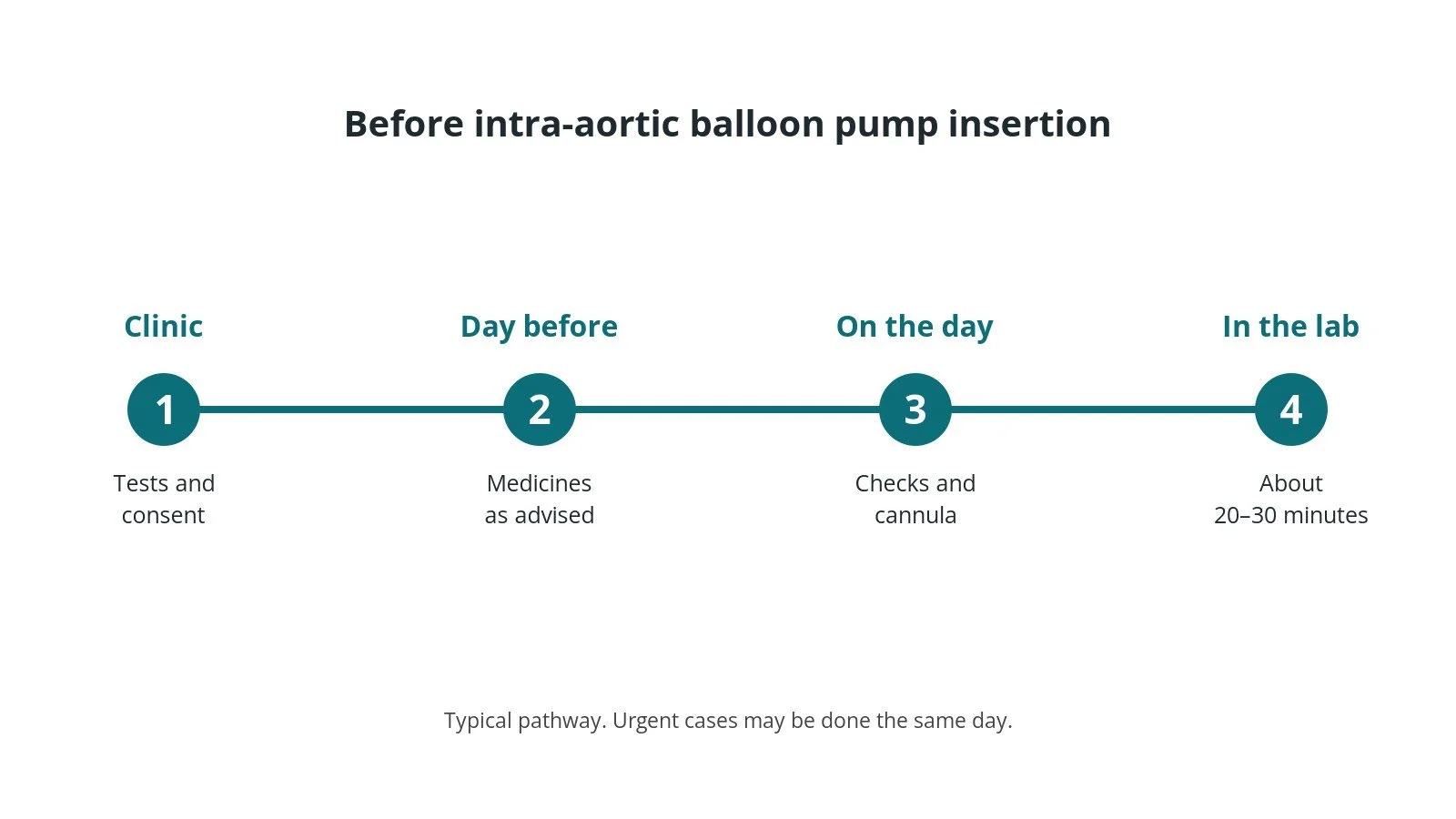 Timeline of the usual steps before intra-aortic balloon pump insertion: clinic tests and consent, medicine advice, checks on the day, and the procedure