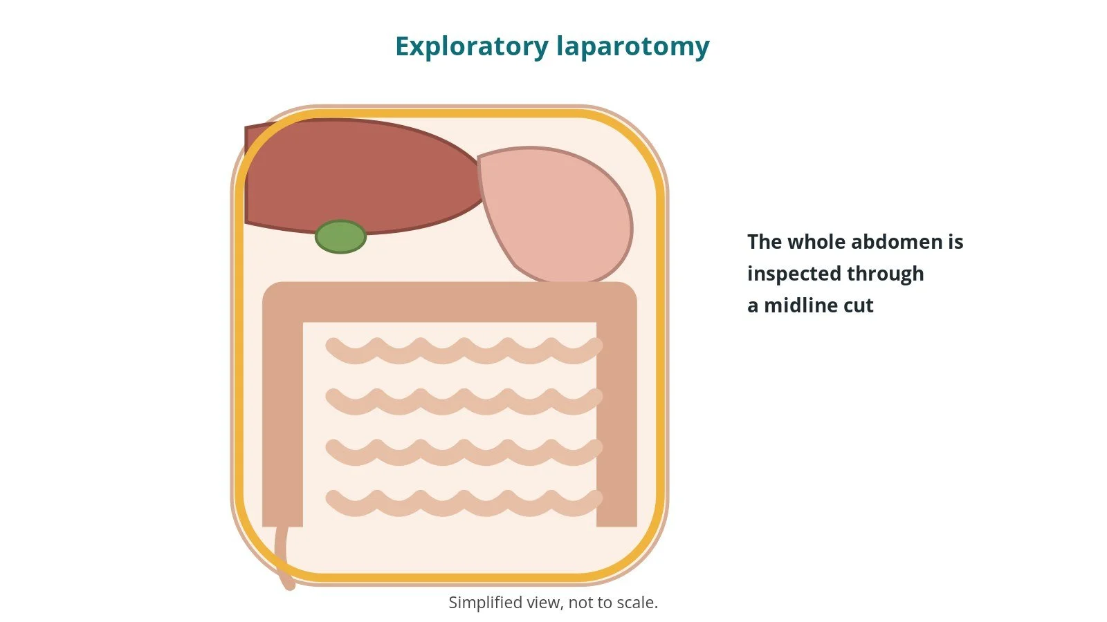 Diagram of the abdomen showing the liver, stomach and bowel, with the whole abdomen outlined to show it is inspected