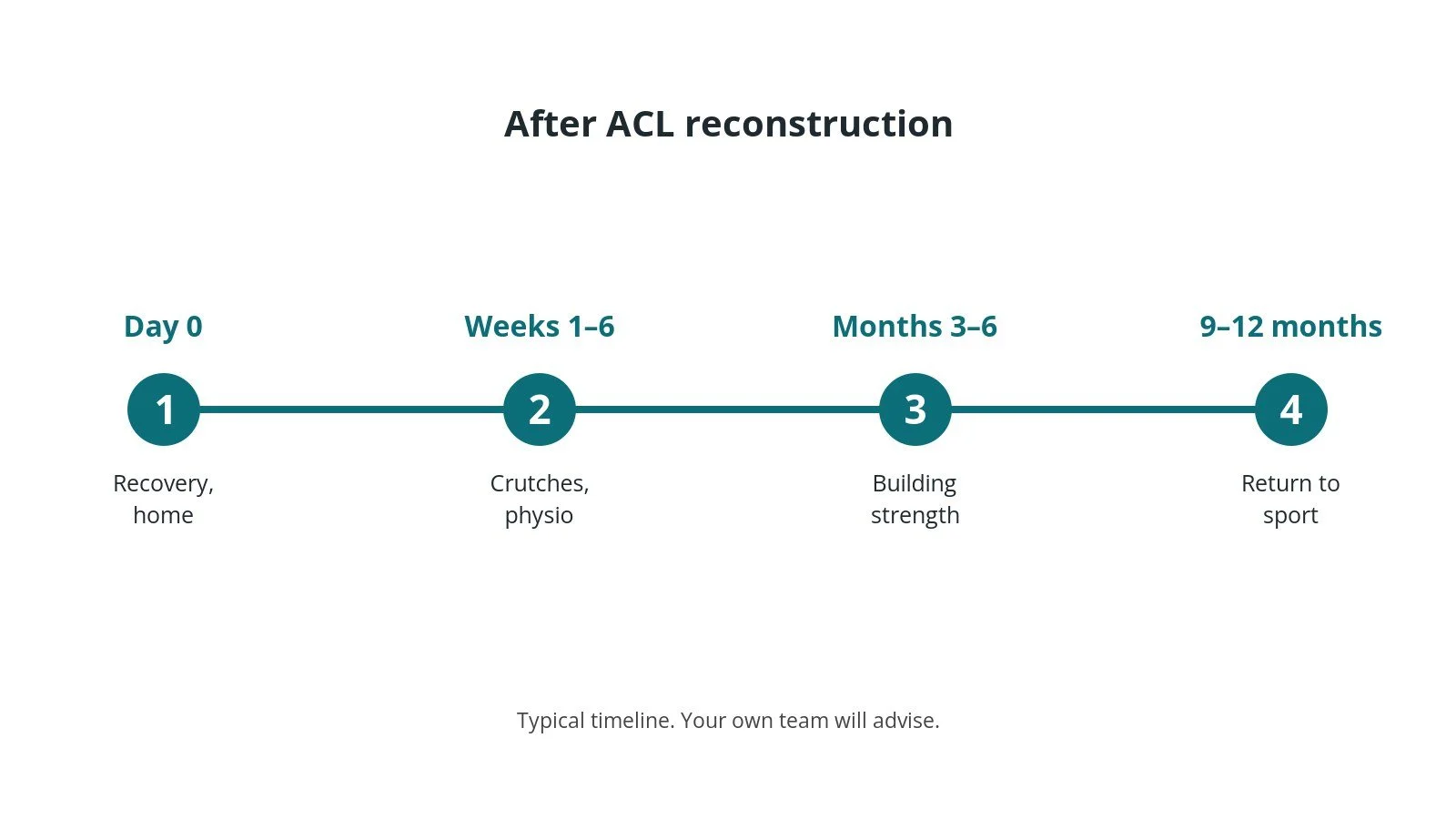 Recovery timeline after ACL reconstruction: Day 0: Recovery, home, Weeks 1–6: Crutches, physio, Months 3–6: Building strength, 9–12 months: Return to sport