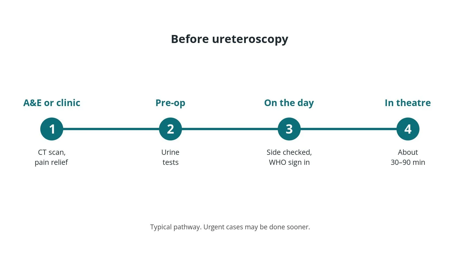 Timeline of the usual steps before ureteroscopy: A&E or clinic: CT scan, pain relief, Pre-op: Urine tests, On the day: Side checked, WHO sign in, In theatre: About 30–90 min