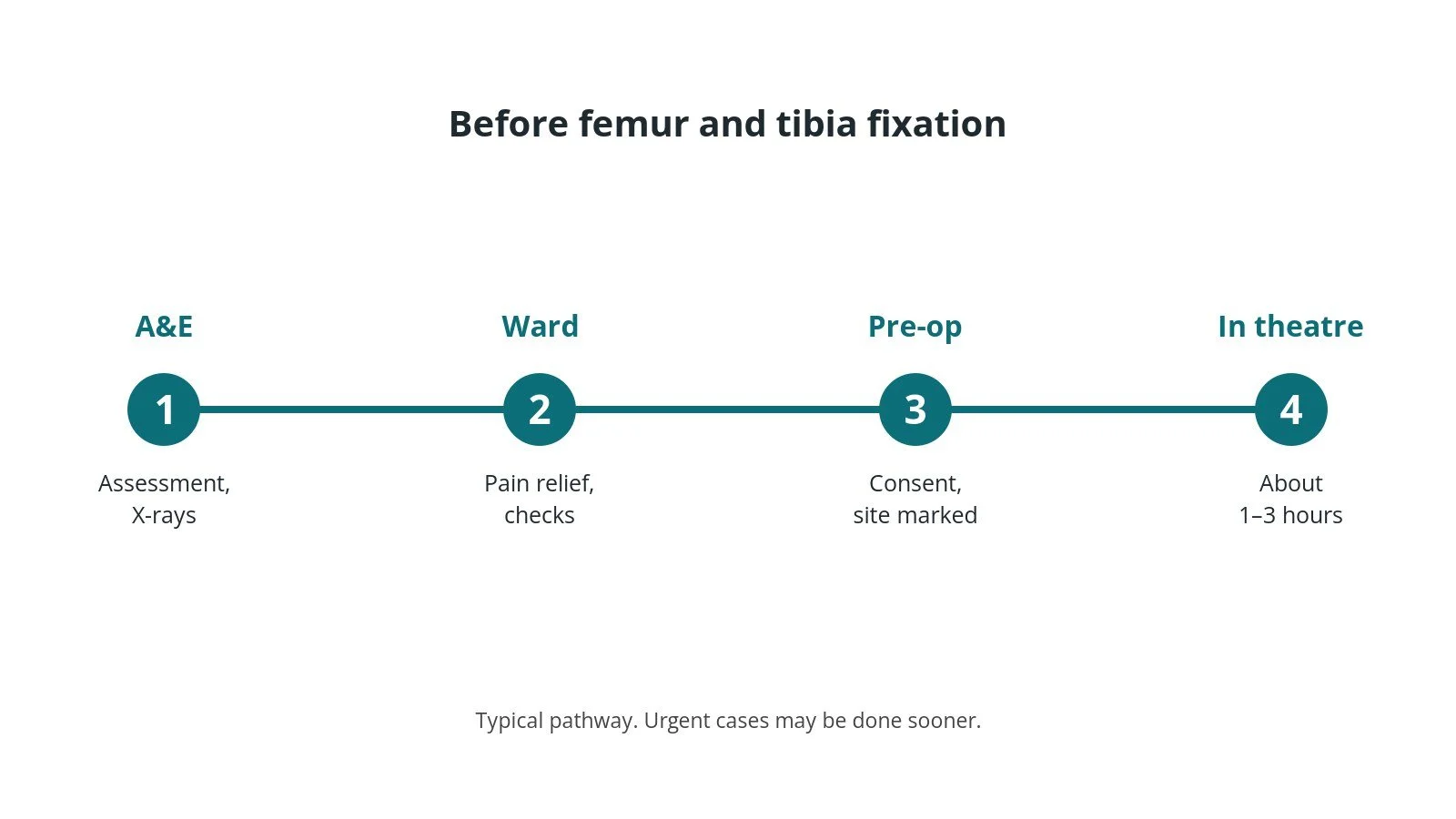 Timeline of the usual steps before femur and tibia fixation: A&E: Assessment, X-rays, Ward: Pain relief, checks, Pre-op: Consent, site marked, In theatre: About 1–3 hours