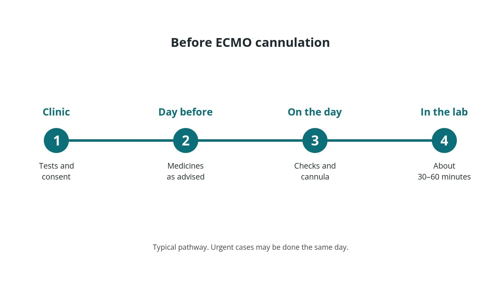 Timeline of the usual steps before ECMO cannulation: clinic tests and consent, medicine advice, checks on the day, and the procedure