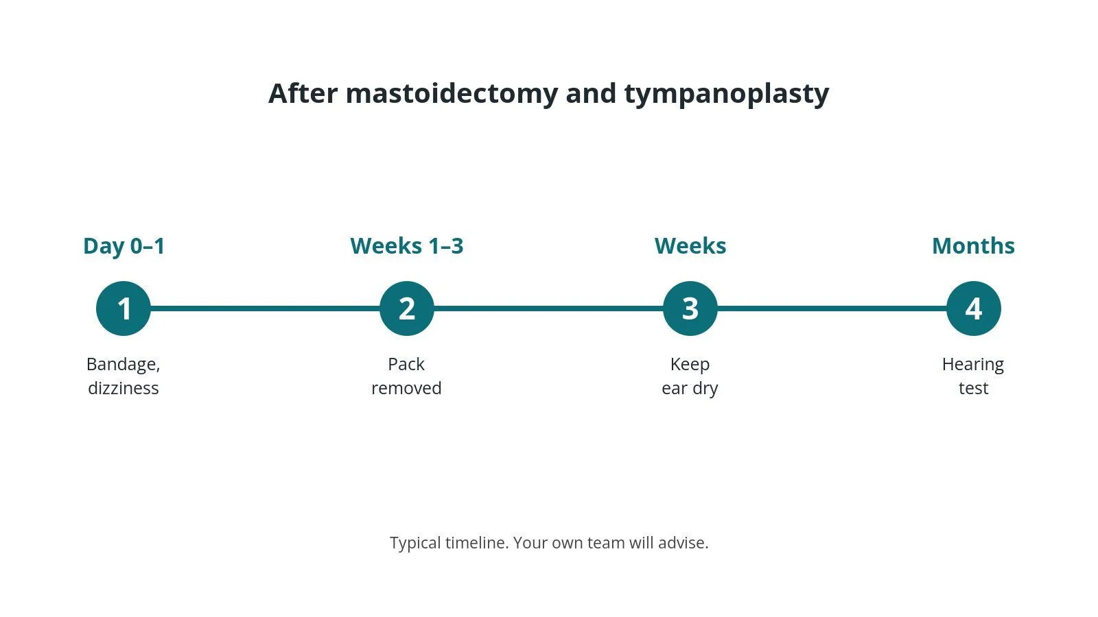 Recovery timeline after mastoidectomy and tympanoplasty: Day 0–1: Bandage, dizziness, Weeks 1–3: Pack removed, Weeks: Keep ear dry, Months: Hearing test